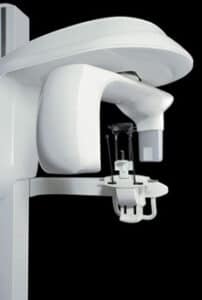 An image of a CS 9300 scanning system